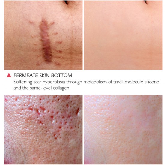 Vibrant Glamour crocodile repair water. Dilution acne marking Vibrant Glamour crocodile repair water. Dilution acne marking