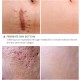 Vibrant Glamour crocodile repair water. Dilution acne marking Vibrant Glamour crocodile repair water. Dilution acne marking