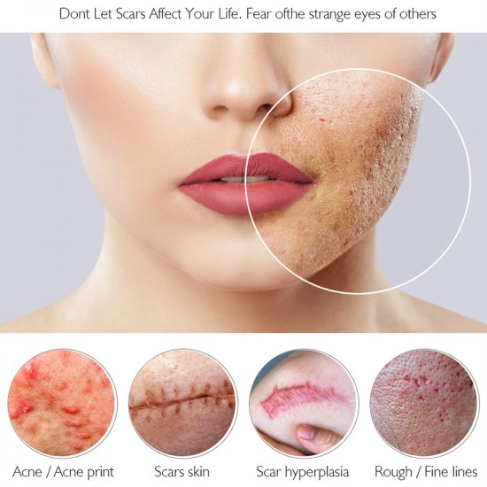 Vibrant Glamour crocodile repair water. Dilution acne marking Vibrant Glamour crocodile repair water. Dilution acne marking