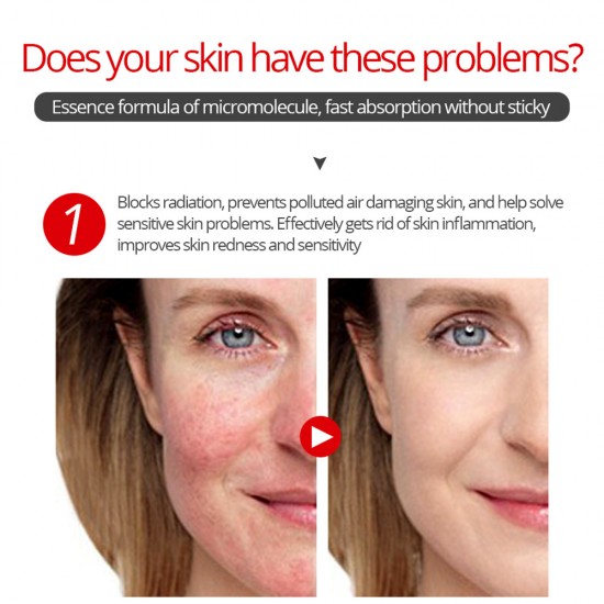 Vibrant Glamour Dragon Blood Essence Condensation. Anti-Wrinkle Moisturizing Mask Firming Moisturizing Vibrant Glamour Dragon Blood Essence Condensation. Anti-Wrinkle Moisturizing Mask Firming Moisturizing