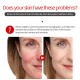 Vibrant Glamour Dragon Blood Essence Condensation. Anti-Wrinkle Moisturizing Mask Firming Moisturizing Vibrant Glamour Dragon Blood Essence Condensation. Anti-Wrinkle Moisturizing Mask Firming Moisturizing