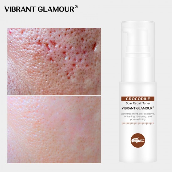 Vibrant Glamour crocodile repair water. Dilution acne marking Vibrant Glamour crocodile repair water. Dilution acne marking