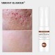 Vibrant Glamour crocodile repair water. Dilution acne marking Vibrant Glamour crocodile repair water. Dilution acne marking