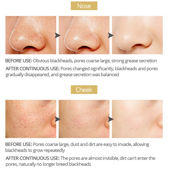 Vibrant Glamour bamboo charcoal to black head to tear nasal film. Clean pores Vibrant Glamour bamboo charcoal to black head to tear nasal film. Clean pores