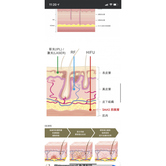 Duolif HIFU & RF Dual-effect Care Device (with HIFU Essence 30ml) Duolif HIFU & RF Dual-effect Care Device (with HIFU Essence 30ml)